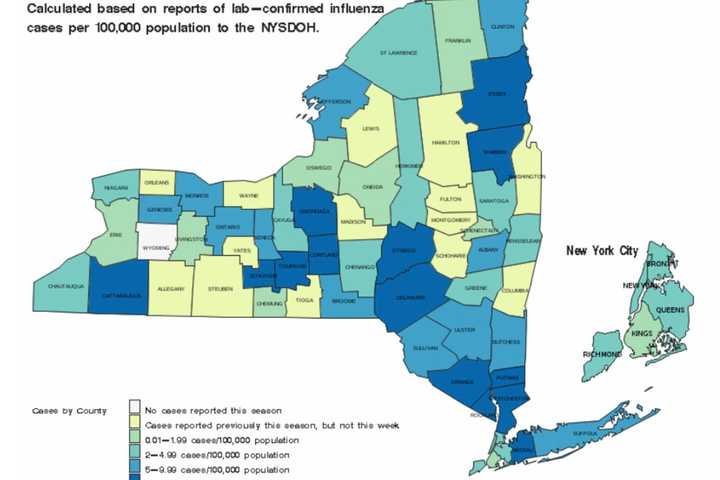 NY Sees New Increase In Flu Cases: Here Are Counties Most Affected