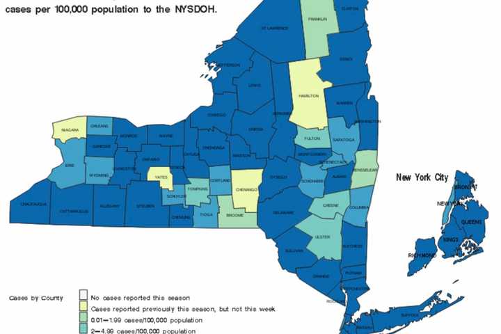 'Widespread' Flu Activity Now Reported In New York: Here Are Counties Most Affected