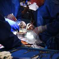 <p>Surgeons in the OR.</p>