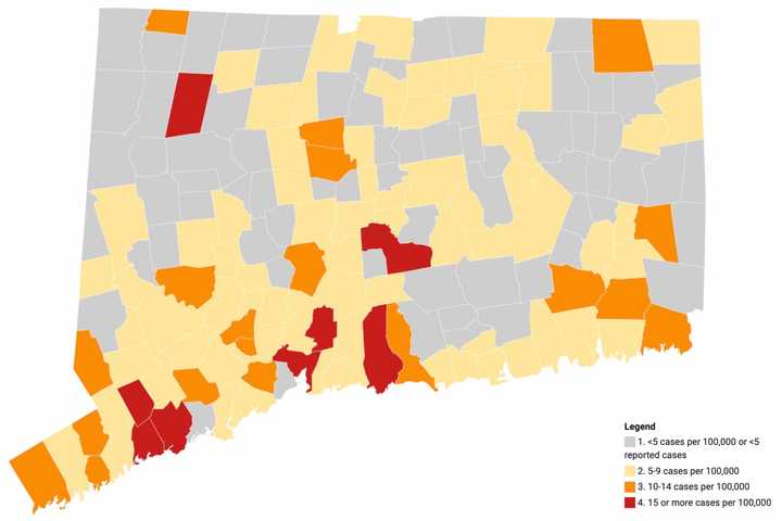 COVID-19: Positivity Rate Near 2.5 Percent In CT, 67 New Deaths Reported