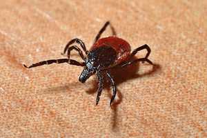 First Case Of Rare 'POW' Virus In CT Confirmed In Windham County