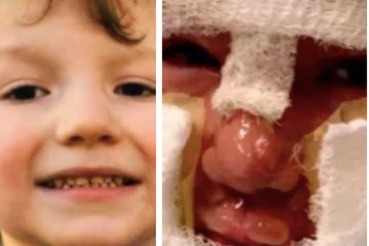 CT Family Says Video Shows 6-Year-Old Wasn’t Set On Fire By Bullies