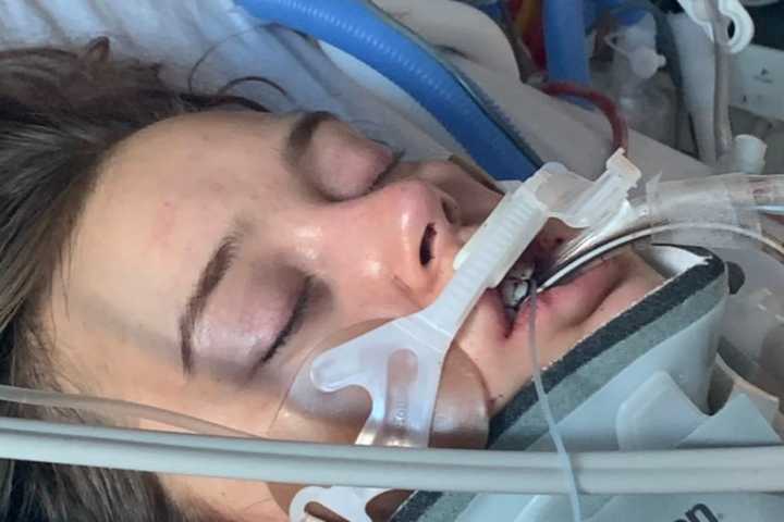 Virginia Nursing Student In ICU After 'Catastrophic' Crash