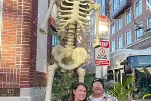 Worcester Couple Lends A Hand — And An Arm — To Cambridge Restaurant In Search Of Bones