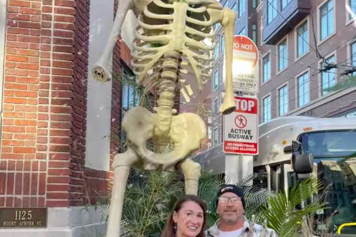 Worcester Couple Lends A Hand — And An Arm — To Cambridge Restaurant In Search Of Bones