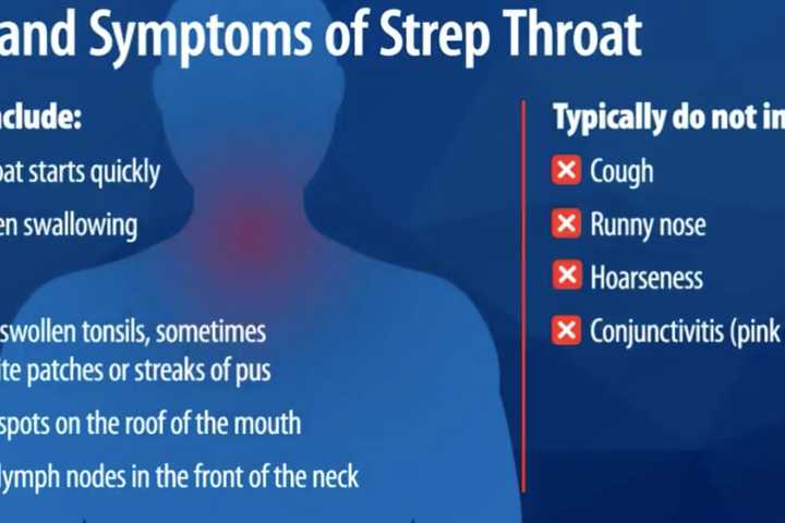 CDC Warns Of Increase In Strep Throat Infections Among Kids Amid Rise In COVID, Flu, RSV Cases