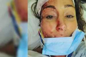 Winchester Spa Owner, Mom Bed-Ridden After Hit By Car Just Before Christmas