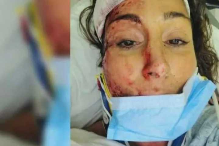 Winchester Spa Owner, Mom Bed-Ridden After Hit By Car Just Before Christmas