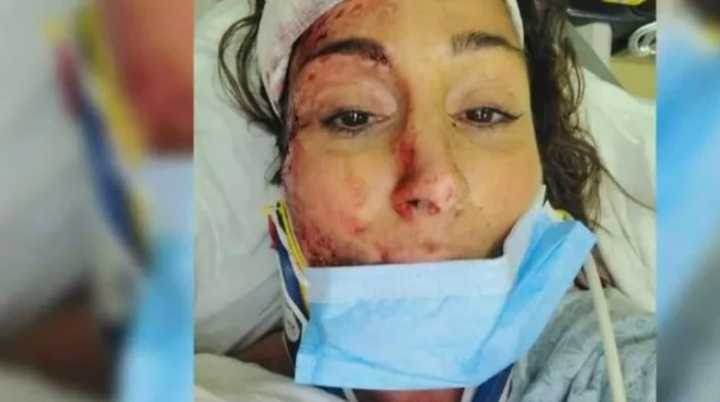 Kathy Auciello is recovering after she was hit by a car while crossing Main Street in Winchester last week.