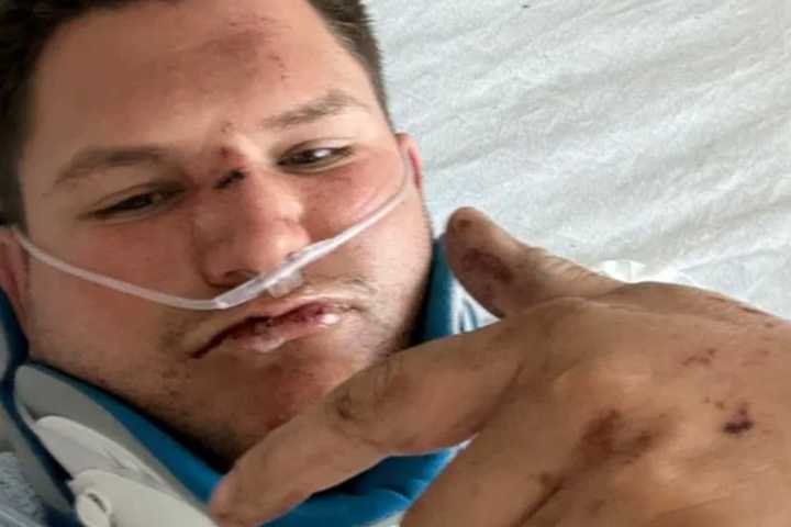 Fire Lieutenant Who Broke Neck In South Jersey Motorcycle Crash Sees Surge Of Support