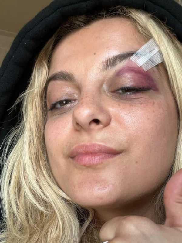 NJ Man Arrested For Throwing Phone At Bebe Rexha Ahead Of Philly Show: NYPD