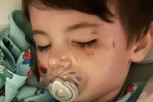 Lawn Mower Severs Hand Of 3-Year-Old Boy In PA