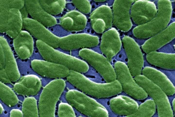 Flesh-Eating Bacteria Infections Pose Growing Threat Nationwide, CDC Warns