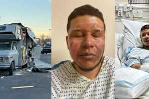 Traveling Barber Burned In RV Explosion In CT: 'This Will Be Long Recovery'