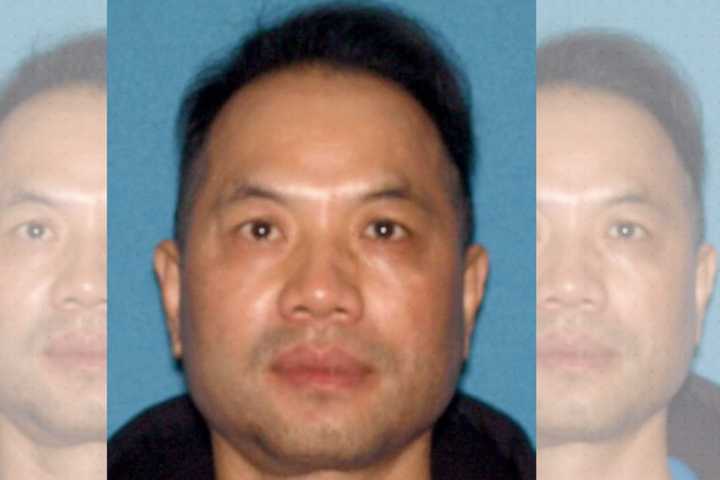 Matawan Acupuncturist Sexually Assaults Patient: Prosecutor