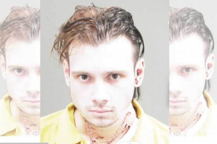 V-Shaped Gashes In Accused Killer's Neck Shown In Chilling Bucks County Mugshot