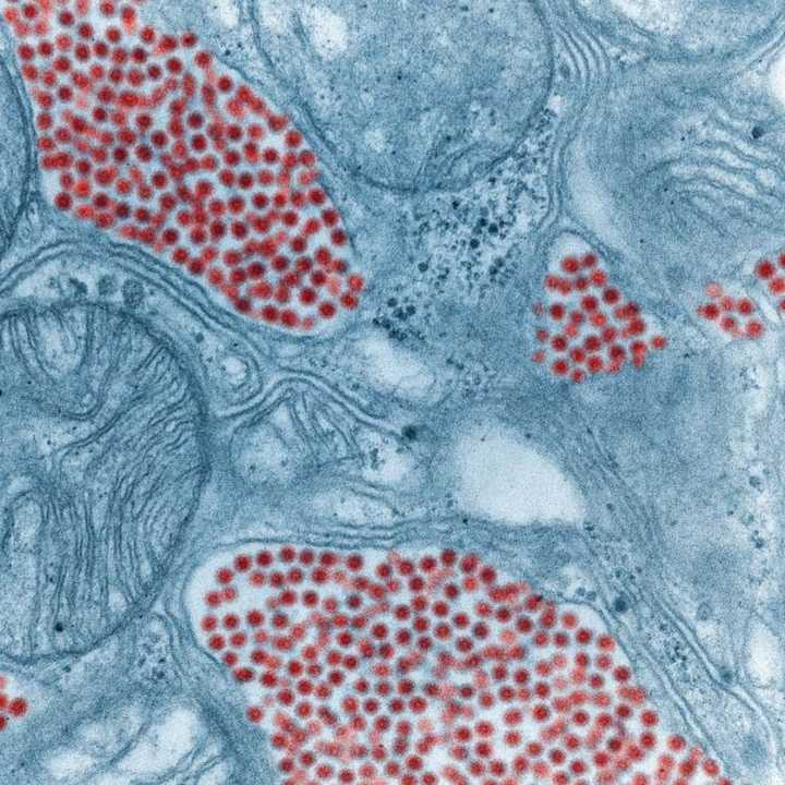 A close up of a mosquito salivary gland infected with EEE. In  Western Massachusetts and Worcester, the risk of contracting EEE or West Nile is low for now.