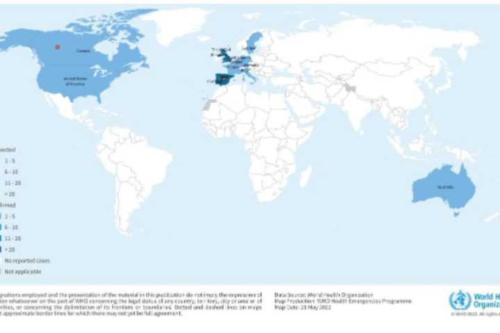 Here's Who Is Most At Risk Of Getting Monkeypox, WHO Says