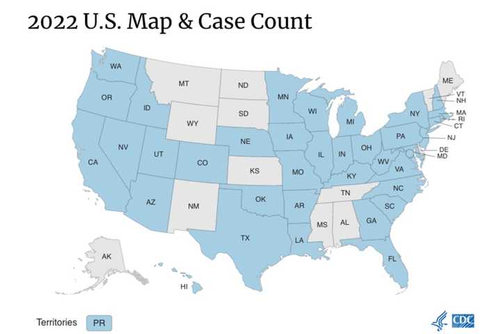 CDC Releases State-By-State Rundown Of Monkeypox Cases