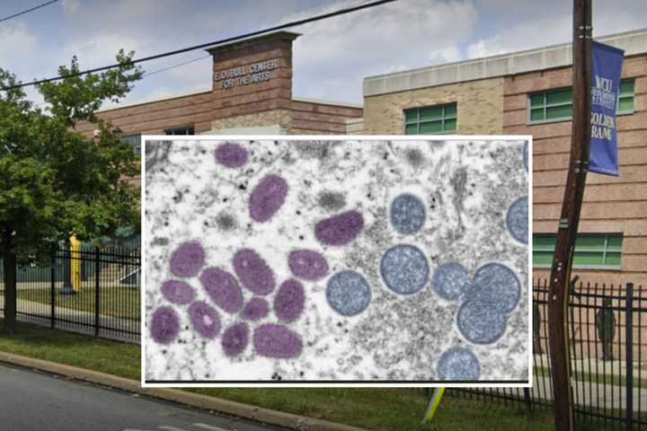 West Chester University Student Tests Positive For Monkeypox