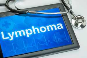 Research Provides Treatment Breakthroughs For Lymphoma