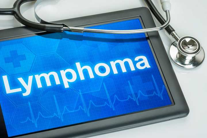 Research Provides Treatment Breakthroughs For Lymphoma