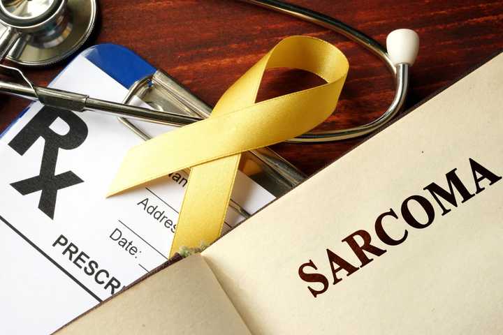 Rare but dangerous, sarcoma is often easiest to treat in its early stages.