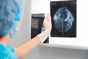 Can Breast Cancer Be Prevented?