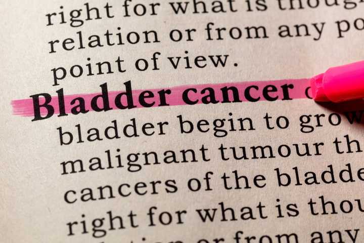 Know The Risks And Symptoms Of Bladder Cancer