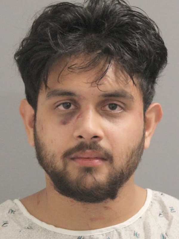 Man Accused Of Assaulting Police Officer In Nassau County