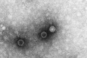Polio Found In Wastewater In NY, Health Dept. Urges Vaccinations