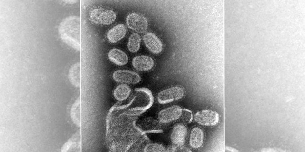 flu-cases-hospitalizations-rising-dramatically-in-new-york-here-s