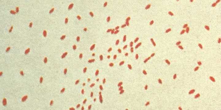 Gram stain of Bordetella pertussis.