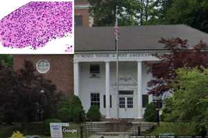 Parasitic Infection Exposure Warning Issued For Events Held In Mount Kisco: Officials