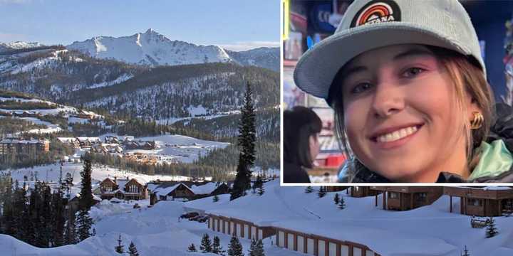 Ana Lynch was seriously injured while skiing in Big Sky, Montana on Sunday, March 10.&nbsp;