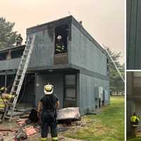 Fire At New York Medical College Housing In Valhalla Displaces Students