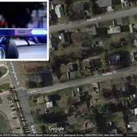 CT Boy Accidentally Shoots Himself In Head While Playing With Gun: Police