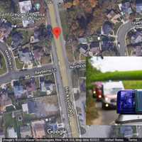 Man Seriously Injured After Being Struck By SUV On Massapequa Roadway