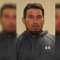 Man's Face Slashed Open As Roofers Trade Insults At Central Mass Party: Police