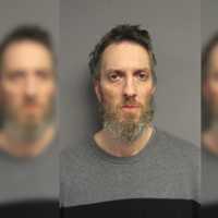 Mass Man Stabbed Dog To Death With Grill Fork In 'Hideous' Killing: Police