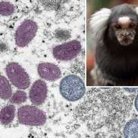 WHO Issues Warning After Reports Of Fatal Attacks On Monkeys Amid Monkeypox Outbreak
