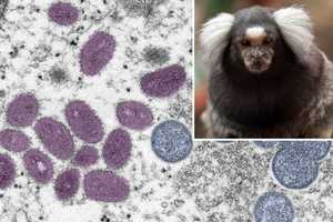 WHO Issues Warning After Reports Of Fatal Attacks On Monkeys Amid Monkeypox Outbreak