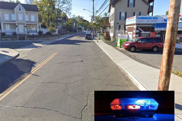 Man Shot In Legs In Fairfield County, Police Say