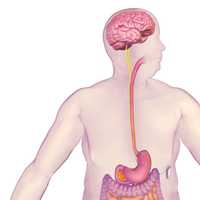 <p>Hackensack University Medical Center has become the first hospital in New Jersey to implant vBloc Therapy for the treatment of obesity, according to an announcement. This illustration shows how vBloc Therapy works.</p>