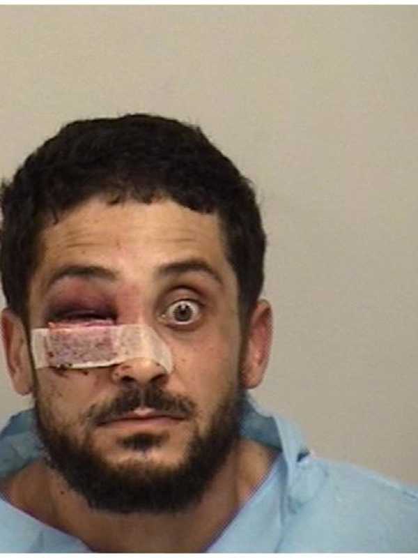 2 Charged With Fighting In Middle Of Road In Westport; 3rd Suspect Sought