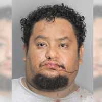 Man Assaults Long Island Nurse Caring For Him, Police Say