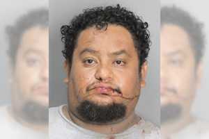 Man Assaults Long Island Nurse Caring For Him, Police Say