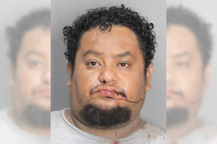 Man Assaults Long Island Nurse Caring For Him, Police Say