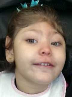 Tricky Tray, Raffle Aids Fair Lawn Girl In Need Of New Mobility Van
