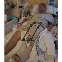 <p>Zachary in the hospital.</p>